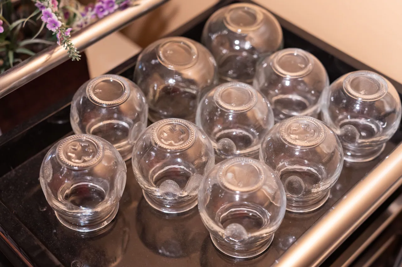 Clear glass cupping jars neatly arranged on a tray